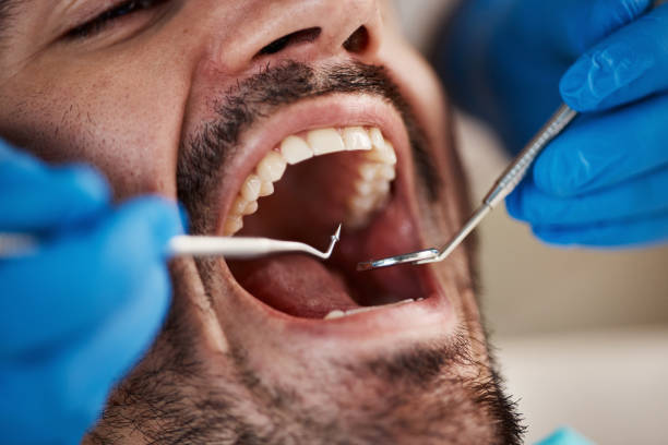 Best Urgent Tooth Repair  in Nixa, MO
