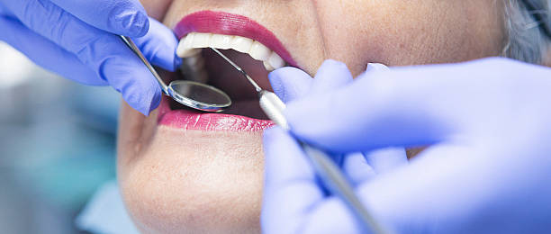 Best Root Canal Emergency Dentist  in Nixa, MO